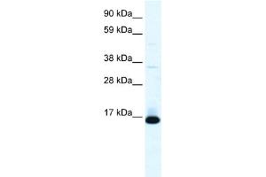 WB Suggested Anti-TCF21 Antibody Titration:  0.