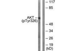 Western blot analysis of extracts from mouse liver, using Akt (Phospho-Tyr326) Antibody. (AKT1 抗体  (pTyr326))