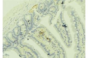 ABIN6279274 at 1/100 staining Mouse colon tissue by IHC-P. (Centriolin 抗体)