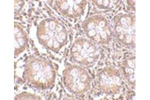 Immunohistochemistry of TEM1 in human colon tissue with this product at 2. (CD248 抗体  (N-Term))