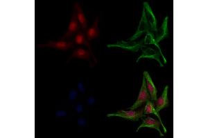 ABIN6259085 and ABIN6275176 staining 3 by IF/ICC.