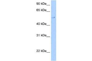 WB Suggested Anti-TERF2 Antibody Titration: 5. (TRF2 抗体  (C-Term))