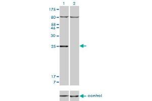 Western blot analysis of HOXB7 over-expressed 293 cell line, cotransfected with HOXB7 Validated Chimera RNAi (Lane 2) or non-transfected control (Lane 1). (HOXB7 抗体  (AA 55-120))