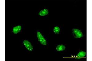 Immunofluorescence of monoclonal antibody to CDC14A on HeLa cell. (CDC14A 抗体  (AA 431-530))