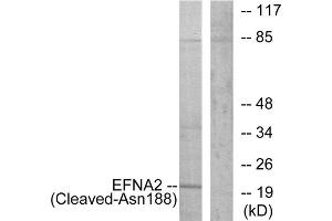 Western blot analysis of extracts from 293 cells, treated with etoposide (25uM, 1hour), using EFNA2 (Cleaved-Asn188) antibody. (Ephrin A2 抗体  (Cleaved-Asn188))