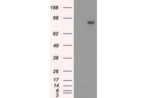 Western Blotting (WB) image for anti-SATB Homeobox 1 (SATB1) antibody (ABIN1500810) (SATB1 抗体)