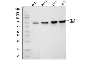 Western blot analysis of DLAT using anti-DLAT antibody (ABIN7602307).
