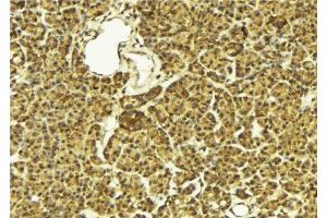 anti-LIM Domain Kinase 2 (LIMK2) (Internal Region) antibody