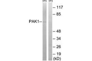 Western blot analysis of extracts from NIH-3T3 cells, treated with UV 15', using PAK1 (Ab-204) Antibody. (PAK1 抗体  (AA 170-219))