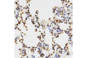 Immunohistochemistry (Paraffin-embedded Sections) (IHC (p)) image for anti-Histone 3 (H3) (H3K9me2) antibody (ABIN3023260)