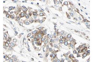 ABIN6267044 at 1/100 staining human Lung tissue sections by IHC-P. (NF-kB p65 抗体  (C-Term))