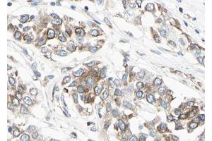 ABIN6267044 at 1/100 staining human Lung tissue sections by IHC-P.