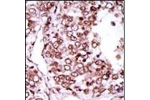 Immunohistochemistry (Paraffin-embedded Sections) (IHC (p)) image for anti-Calcium/calmodulin-Dependent Protein Kinase II gamma (CAMK2G) (AA 309-338), (C-Term) antibody (ABIN391313)