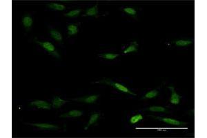Immunofluorescence of purified MaxPab antibody to NFAT5 on HeLa cell. (NFAT5 抗体  (AA 1-1484))
