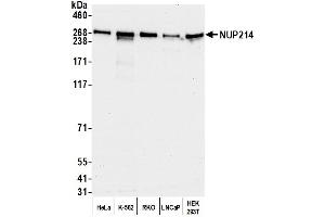 Western Blotting (WB) image for anti-Nucleoporin 214kDa (NUP214) (AA 1250-1300) antibody (ABIN7450514)