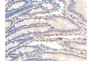 Immunohistochemistry (IHC) image for anti-Neurotrophic Tyrosine Kinase, Receptor, Type 1 (NTRK1) (pTyr681), (Tyr680) antibody (ABIN6256787)