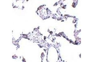 Immunohistochemistry (IHC) image for anti-CD81 (CD81) (N-Term) antibody (ABIN1031309) (CD81 抗体  (N-Term))