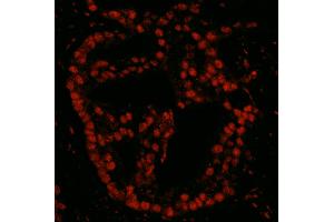 Immunofluorescence (IF) image for anti-PDS5, Regulator of Cohesion Maintenance, Homolog B (PDS5B) (AA 1200-1250) antibody (ABIN7448998)