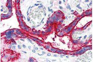 Human Placenta (formalin-fixed, paraffin-embedded) stained with CD59 antibody ABIN290285 at 10 ug/ml followed by biotinylated anti-mouse IgG secondary antibody ABIN481714, alkaline phosphatase-streptavidin and chromogen. (CD59 抗体)