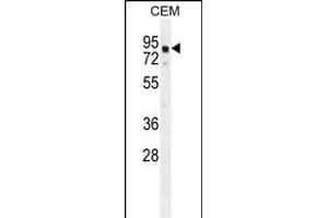 GLB1L2 Antibody (C-term) (ABIN654822 and ABIN2844495) western blot analysis in CEM cell line lysates (35 μg/lane). (GLB1L2 抗体  (C-Term))