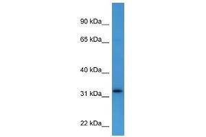 Western Blot showing DOK4 antibody used at a concentration of 1-2 ug/ml to detect its target protein. (DOK4 抗体  (C-Term))