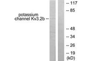 Western blot analysis of extracts from HepG2 cells, using Potassium Channel Kv3. (Kv3.2b Potassium Channel 抗体  (AA 589-638))
