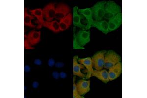 ABIN6257277 and ABIN6275882 staining Hela cells by IF/ICC. (IL-21 抗体  (Internal Region))