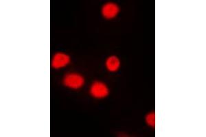 Immunofluorescent analysis of SIX6 staining in NIH3T3 cells. (SIX Homeobox 6 抗体  (Center))