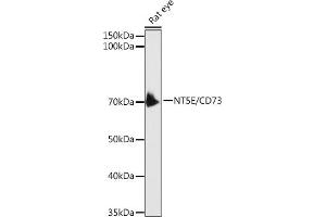 Western Blotting (WB) image for anti-5'-Nucleotidase, Ecto (CD73) (NT5E) (AA 290-550) antibody (ABIN3022734)