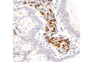 Immunohistochemistry analysis of paraffin-embedded mouse kidney using,STC (ABIN7075723) at dilution of 1: 800 (Stanniocalcin 1 抗体)