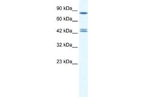 WB Suggested Anti-CBX8 Antibody Titration:  0. (CBX8 抗体  (Middle Region))