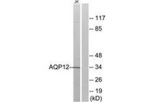 Western blot analysis of extracts from Jurkat cells, using AQP12 Antibody.
