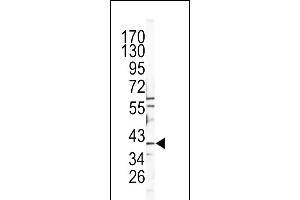 Western blot analysis of CATB Antibody (Center) (ABIN391549 and ABIN2841498) in Y79 cell line lysates (35 μg/lane). (Tyrosinase-Related Protein 1 抗体  (AA 198-227))