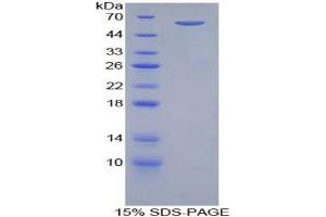 SDS-PAGE analysis of Human ADRbK1 Protein. (GRK2 蛋白)