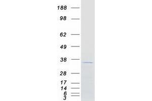 Western Blotting (WB) image for NEDD4 Binding Protein 2-Like 1 (N4BP2L1) (Transcript Variant 1) protein (Myc-DYKDDDDK Tag) (ABIN2727062)