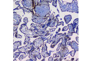 Immunohistochemistry (IHC) image for anti-Integrin, alpha 5 (ITGA5) (AA 42-263) antibody (ABIN5693202)