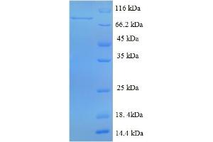SDS-PAGE (SDS) image for DENN/MADD Domain Containing 1A (DENND1A) (AA 1-559), (full length) protein (His-SUMO Tag) (ABIN5711547)