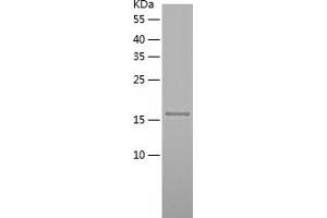 DUSP18 Protein (AA 1-188) (His tag)