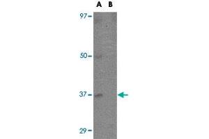 Western blot analysis of EBI3 in K-562 cell lysate with EBI3 polyclonal antibody  at 1 ug/mL in (A) the absence and (B) the presence of blocking peptide. (EBI3 抗体  (C-Term))