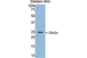 Western blot analysis of the recombinant protein. (RALBP1 抗体  (AA 192-380))