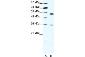 WB Suggested Anti-GDI1 Antibody Titration:  1. (GDI1 抗体  (C-Term))