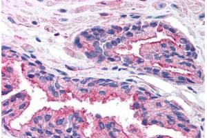 Human Prostate (formalin-fixed, paraffin-embedded) stained with RAB14 antibody ABIN214804 at 5 ug/ml followed by biotinylated goat anti-rabbit IgG secondary antibody ABIN481713, alkaline phosphatase-streptavidin and chromogen. (RAB14 抗体  (C-Term))