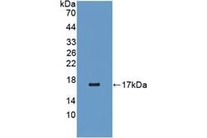 Western blot analysis of recombinant Human RBP5. (Retinol Binding Protein 5 抗体  (AA 2-135))