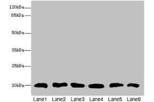 Western blot All lanes: CFL2 antibody at 3. (Cofilin 2 抗体  (AA 1-166))