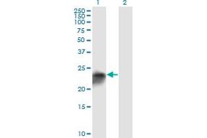 Western Blotting (WB) image for anti-Ubiquitin Carboxyl-terminal Esterase L1 (Ubiquitin Thiolesterase) (UCHL1) (AA 1-223) antibody (ABIN563332)