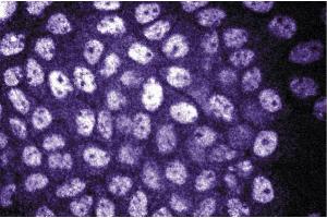 Immunofluorescence staining of A431 cells (Human epithelial carcinoma, ATCC CRL-1555). (DDB1 抗体  (AA 739-935))