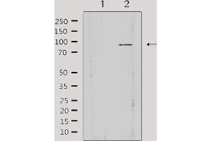 Western blot analysis of extracts from HepG2, using AKAP3 Antibody. (AKAP3 抗体  (Internal Region))