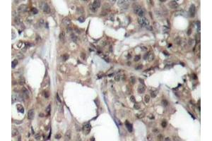 Image no. 3 for anti-V-Akt Murine Thymoma Viral Oncogene Homolog 1 (AKT1) antibody (ABIN265302) (AKT1 抗体)