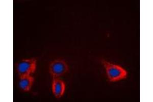 Immunofluorescent analysis of TRK B staining in HL60 cells. (TRKB 抗体  (Center))