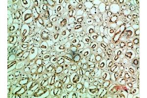 Immunohistochemical analysis of paraffin-embedded human-kidney, antibody was diluted at 1:200 (Fibronectin 1 抗体  (AA 1268-1341))